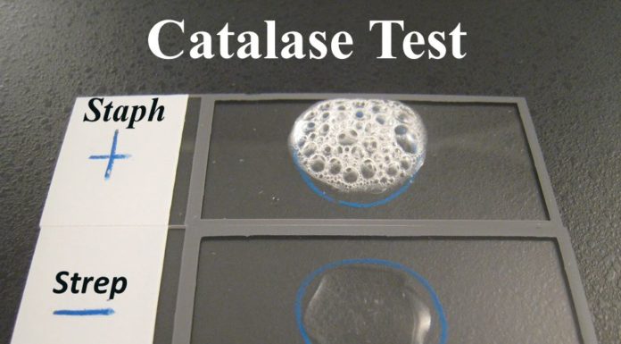 Catalase Test