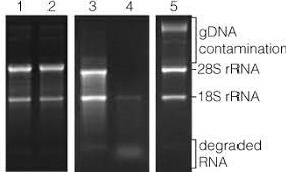 RNA integrity gel