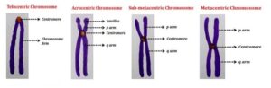 انواع سانترومر کروموزوم ها