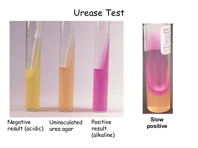 Urease Test